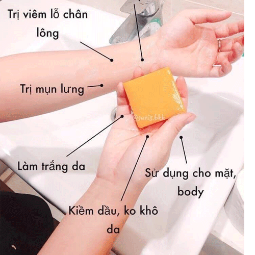 Xà Phòng Làm Trắng Da - Trị Mụn - Trị Thâm Thái Lan