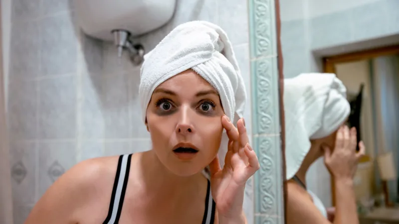 Giải Pháp Trị Thâm Quầng Mắt Do Thức Khuya Nhanh Chóng, Hiệu Quả