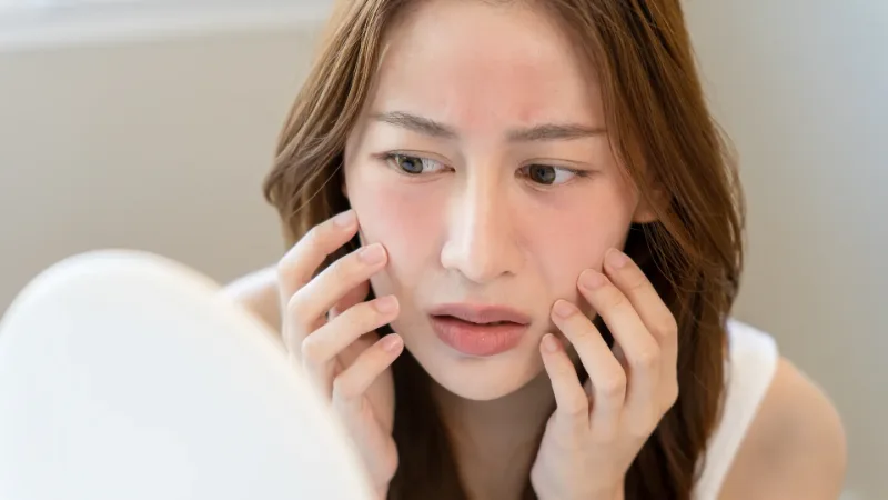 Phòng Tránh Dị Ứng Da Do Thời Tiết Thay Đổi Thất Thường